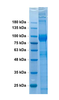 HA (A/Massachusetts/18/2022)(H3N2) protein (reducing condition)